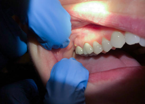 Best Knocked-Out Tooth Emergency  in Shell Point, SC